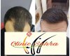Clinic Sahra Hairtransplant