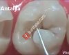 Dentantalya Ağız ve Diş Sağlığı Polikliniği
