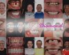 Diamond Dental Antalya Turkey