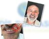Diş Dünyası - Ağız Ve Diş Sağlığı Polikliniği Bulgurlu/ÜSKÜDAR