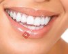 Estetica Dental Ağız ve Diş Sağlığı Polikliniği Merkez