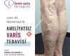 İzmir Varis Terapisi