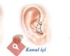 Karacan İşitme Cihazları