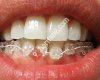 Kütahya Ortodonti Uzmanı Onur GÖRCEK