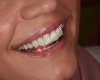 Özel Çapa Cerrahi & Estetik Diş Polikliniği