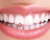 Özel Mezitli Ağız ve Diş Sağlığı Polikliniği