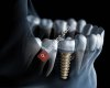 Özel Sardent Ağız Ve Diş Sağlığı Polkliniği