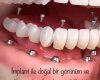 Profdent-Doğubeyazıt