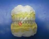 Yaşar Dent Çok Amaçlı Diş Protez ve Ortodonti Laboratuarı