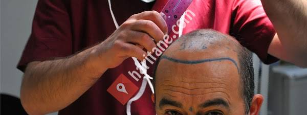 Ankara international Saç Ekimi - Doç.Dr.Serdar Gökrem