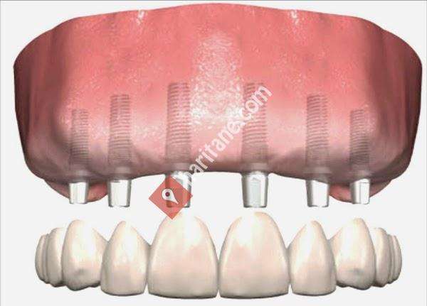 Aydosdiş Ağız ve Diş Sağlığı Polikliniği