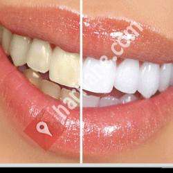 Beyaz Işık Ağız ve Diş Sağlığı Polikliniği