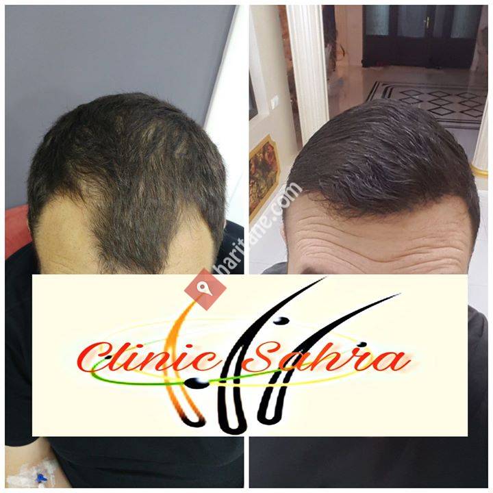 Clinic Sahra Hairtransplant