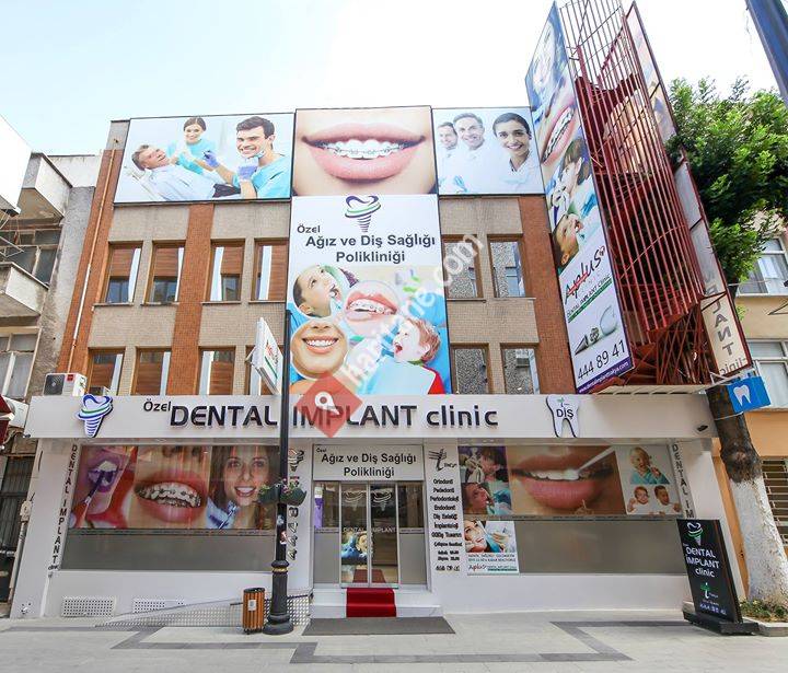 Dental Implant Clinic A Plus