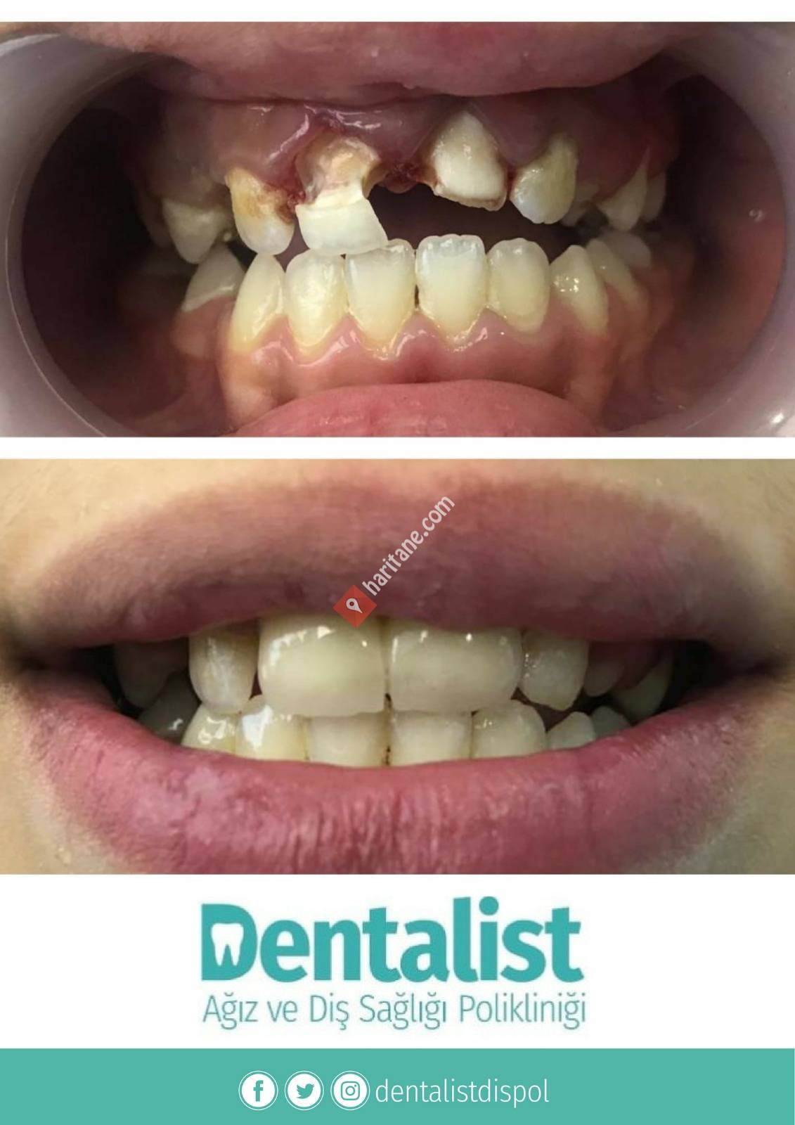 Dentalist Diş Polikliniği