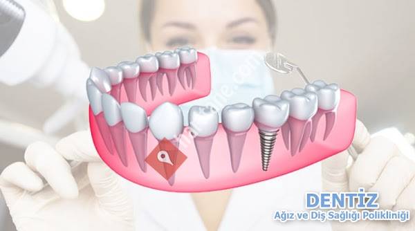 Dentiz Ağız ve Diş Sağlığı Polikliniği