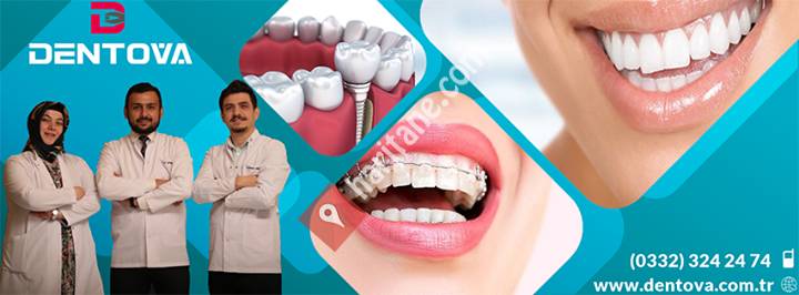 Dentova Estetik Diş Ve Implant Merkezi