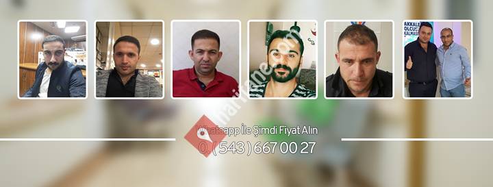 Gaziantep Fue Saç Ekimi