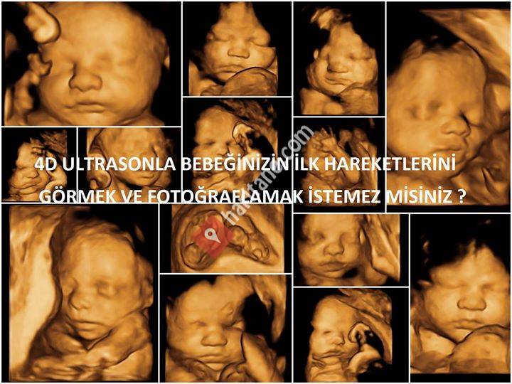 Özel Ankara Lina Kadın Hastalıkları ve Doğum Merkezi