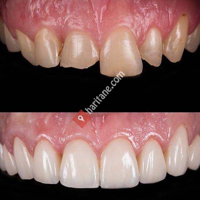 Özel Efedent Diş Protez Laboratuvar Hizmetleri Ltd. Şti.