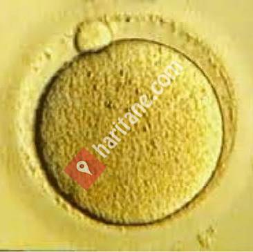 Tüp Bebek Merkezi Kayseri - Tüp Bebek Uzmanı - Embriyolog