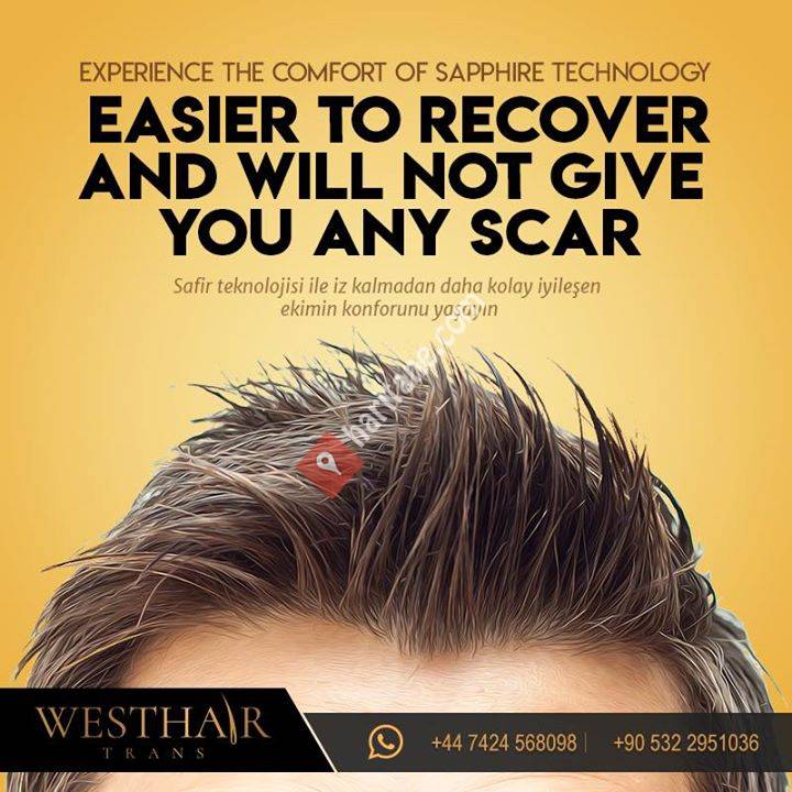 West Hairtransplant